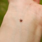 В Тверской области клещи покусали около 300 человек