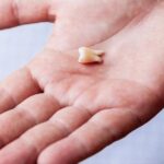 Быстрая потеря зубов – признак близкой смерти