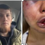 В Твери боец ММА из Дагестана жестоко искалечил свою подругу  