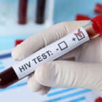 Тверская область на 52-м месте в стране по заболеваемости ВИЧ, в регионе насчитывается 7 тысяч ВИЧ-инфицированных