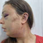 После публикации об избиении женщины в Тверской области возбуждено уголовное дело